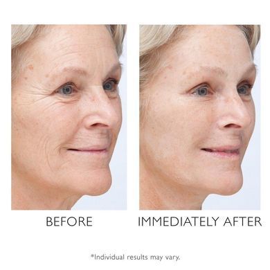 Фото Антивіковий крем для обличчя Peter Thomas Roth Instant FirmX Temporary Face Tightener 100 мл Temporary Face Tightener