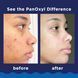 Пінка для вмивання від акне PanOxyl Acne Foaming Wash 10% Maximum Strength 156 g