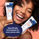 Зволожуючий денний крем PanOxyl Balancing Repair Moisturizer 4% Niacinamide 170 г