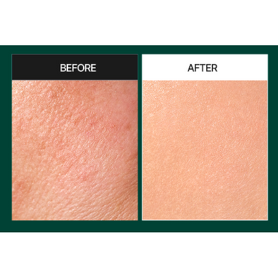 Фото Сироватка з мікроголками MediPeel Phyto Cica Nol B5 6000 Shot Serum, 50 г Phyto Cica Nol B5 6000 Shot