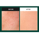 Сироватка з мікроголками MediPeel Phyto Cica Nol B5 6000 Shot Serum, 50 г