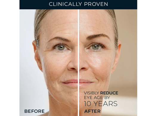 Фото Крем для корекції шкіри під очима RoC Retinol Correxion, 15 мл Retinol Correxion