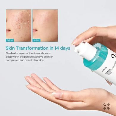 Фото Тонер для лица с салициловой кислотой Anua BHA 2% Gentle Exfoliating Toner 150 мл BHA 2%