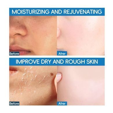 Фото Увлажняющий крем для лица Enjoy Skin Hyaluronic Acid Capsule